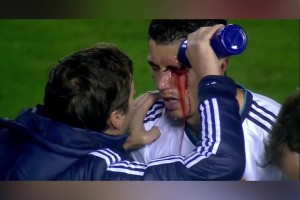 硬汉！C罗眉骨破裂现场缝针，单眼进球霸气回击对手！